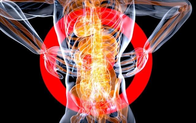 Low back pain causes and treatment